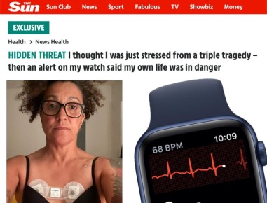 Apple Watch   ,  ,     ,    