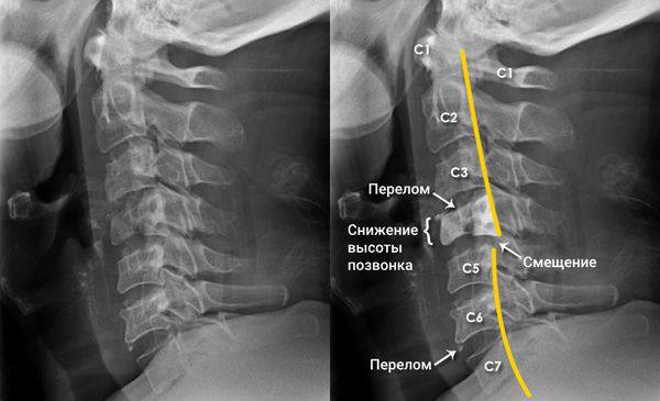 Еженедельная авторская колонка;