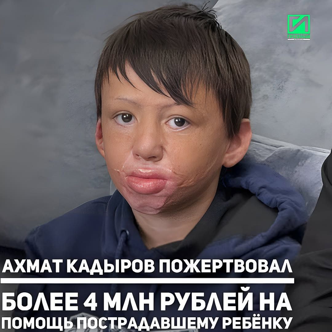 Министр Чеченской Республики по физической культуре и спорту Ахмат Кадыров пожертвовал более 4 миллионов рублей на лечение Джабраила Солтаева