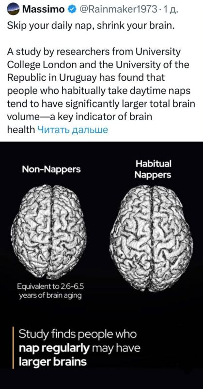 Регулярный дневной сон замедляет старение мозга и повышает продуктивность — учёные