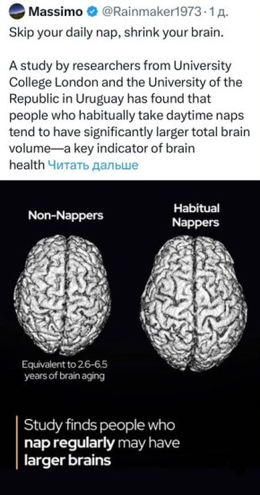 Регулярный дневной сон замедляет старение мозга и повышает продуктивность — учёные