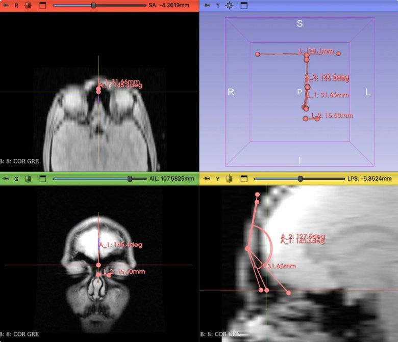 Интернет теперь можно понюхать — ученые научились передавать ароматы прямо в мозг через ультразвук в наушниках